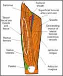 Anterolateral Thigh Flap