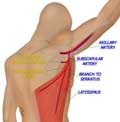 Musculocutaneous Latissimus Dorsi Flap